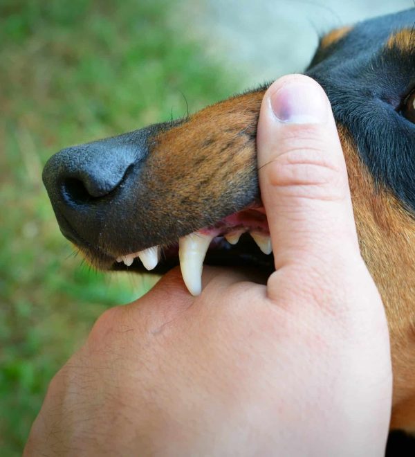 Persona con una mordedura de perro en la mano tras un incidente en Austin, Texas, ilustrando una posible reclamación por gastos médicos, dolor y sufrimiento.